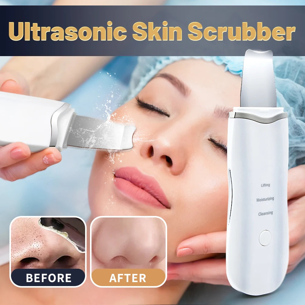 GlowWave™ – Ultrasonic Skin Scrubber | Deep Pore Cleanser & Blackhead Remover with Ion + EMS Technology